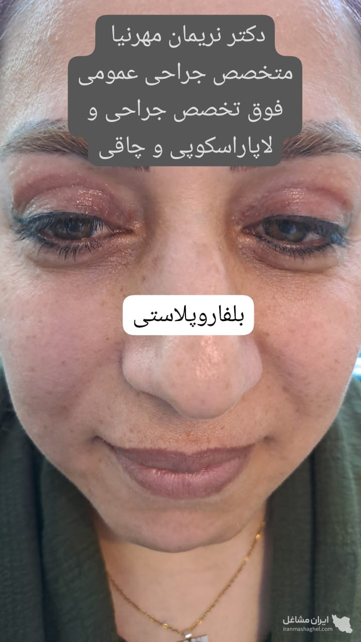 مطب تخصصی پوست و مو دکتر نریمان مهرنیا در تهرانپارس تهران
